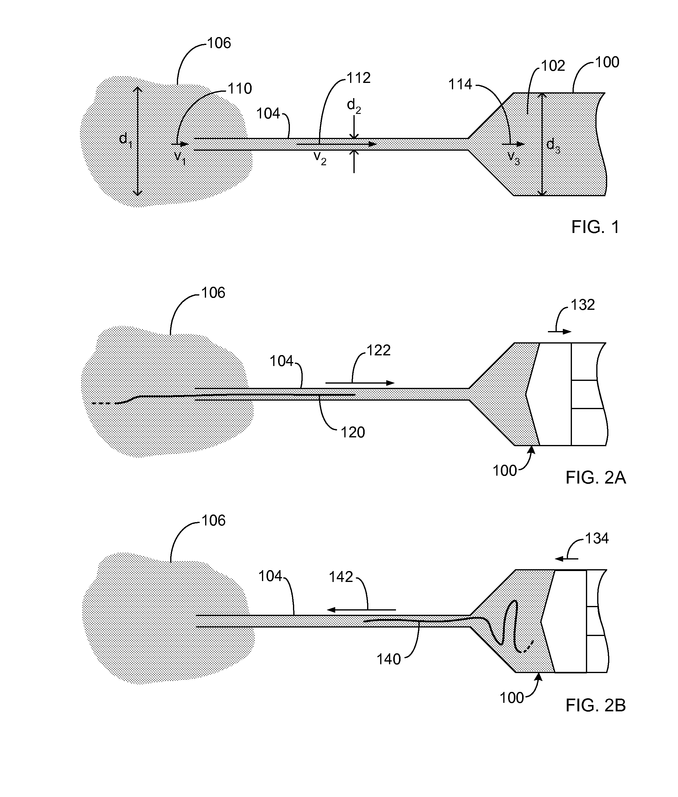 Suture passer