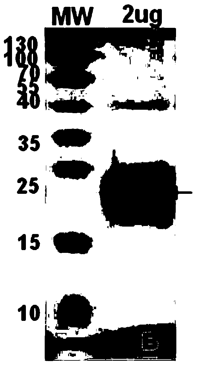 Chemiluminiscence kit for detecting human epididymis secretory protein 4