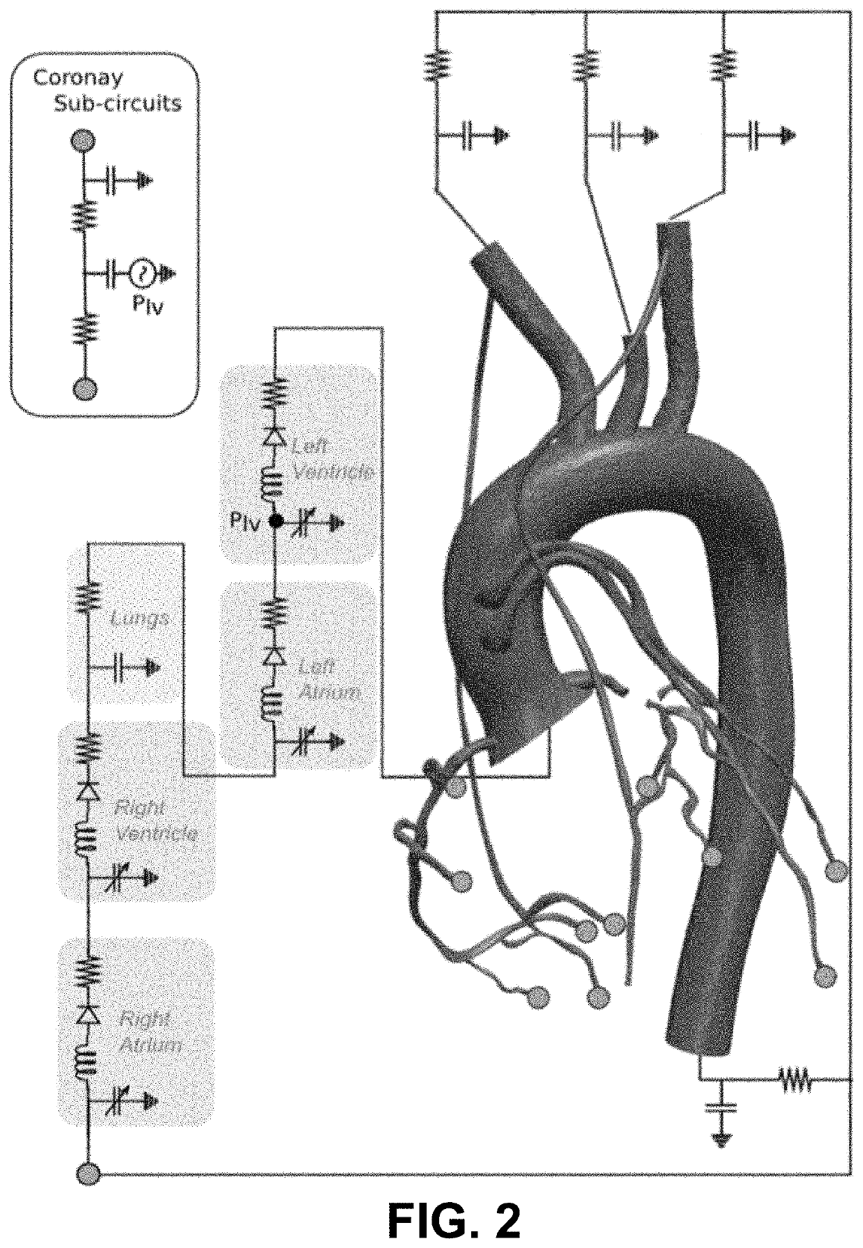 Hemodynamic and Morphological predictors of Vascular Graft Failure