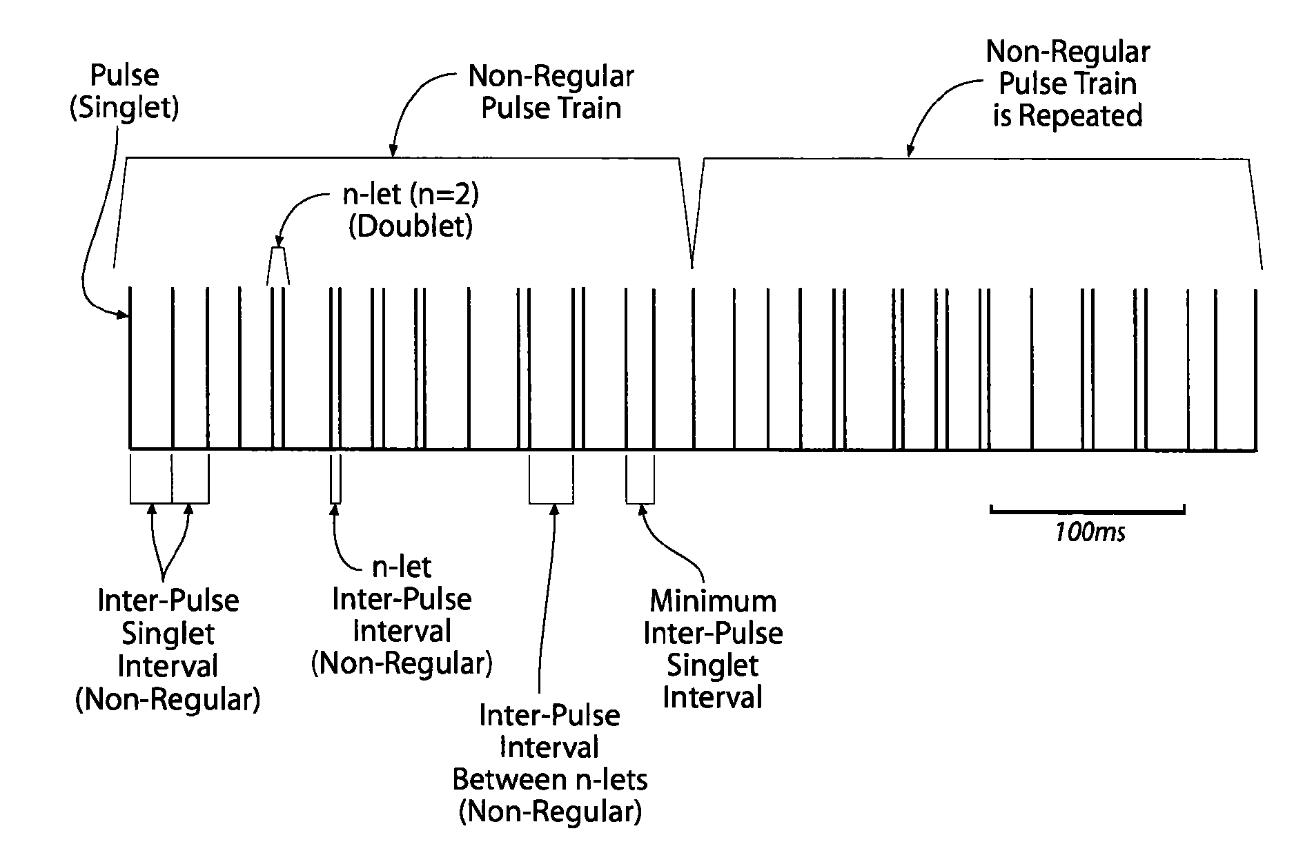 Non-regular electrical stimulation patterns for treating neurological disorders