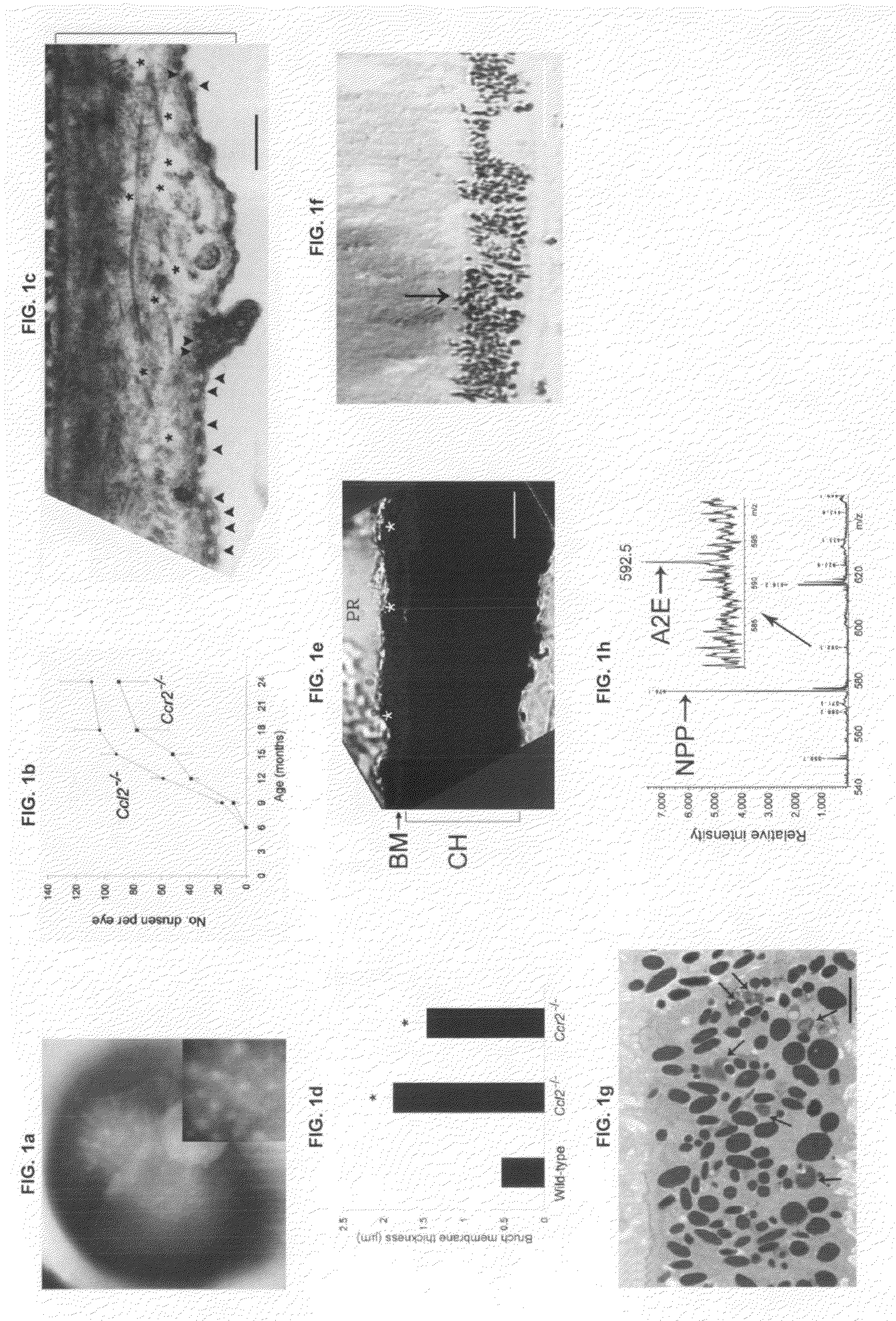 Methods and animal model for analyzing age-related macular degeneration