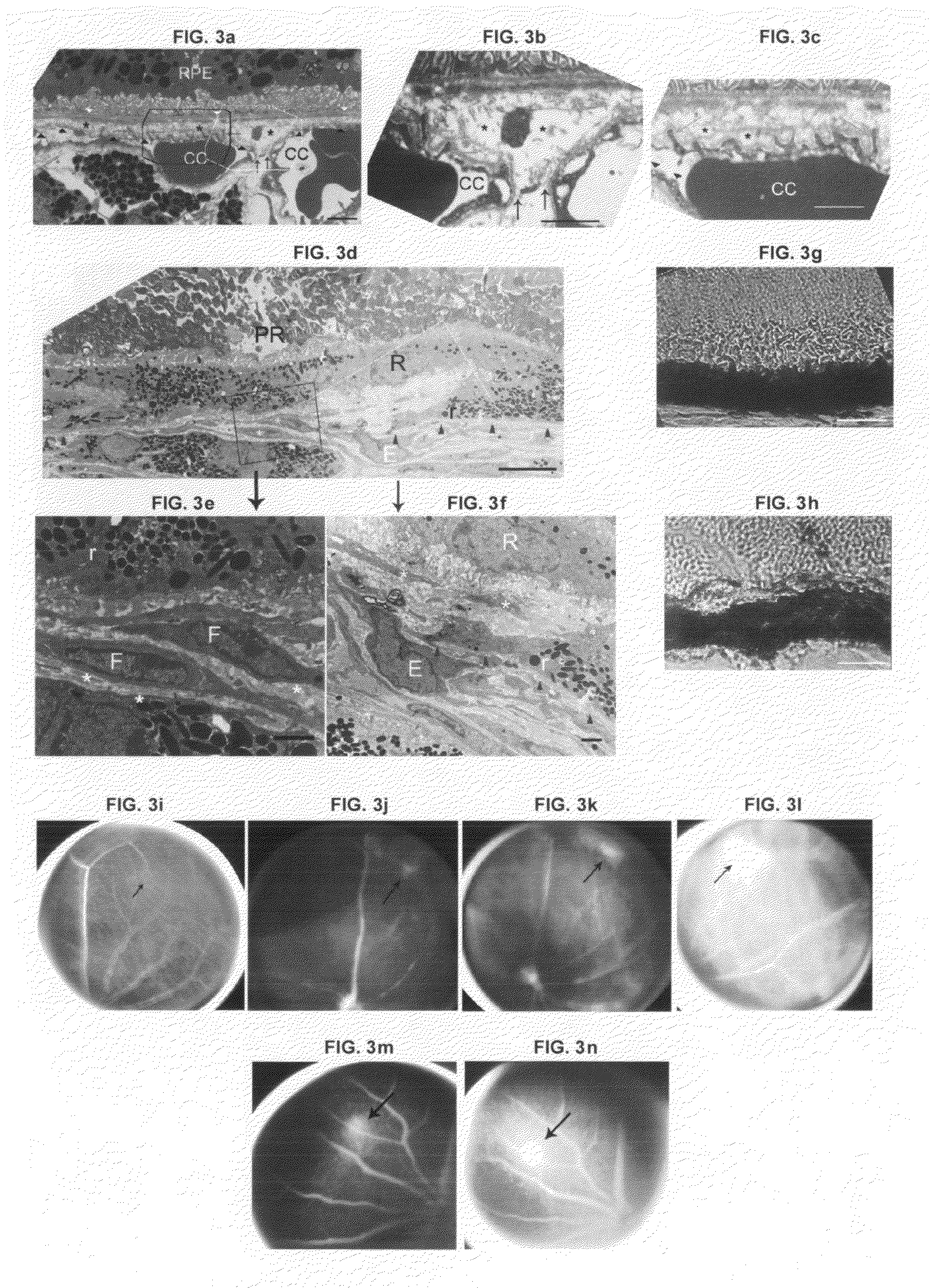 Methods and animal model for analyzing age-related macular degeneration