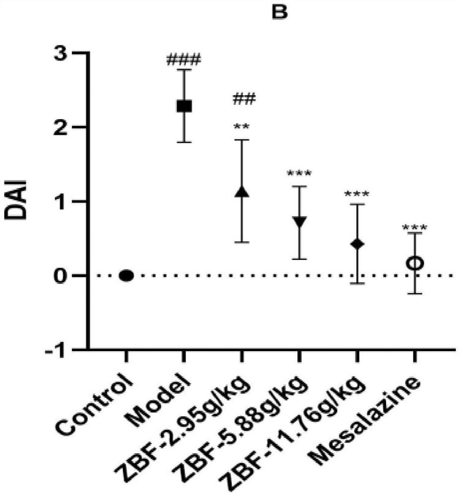 Chinese medicine composition for treating ulcerative colitis, Chinese medicine preparation and application thereof