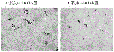 Preparation method of thymidine kinase 1 antibody and application of thymidine kinase 1 antibody in proliferation of ureaplasma urealyticum