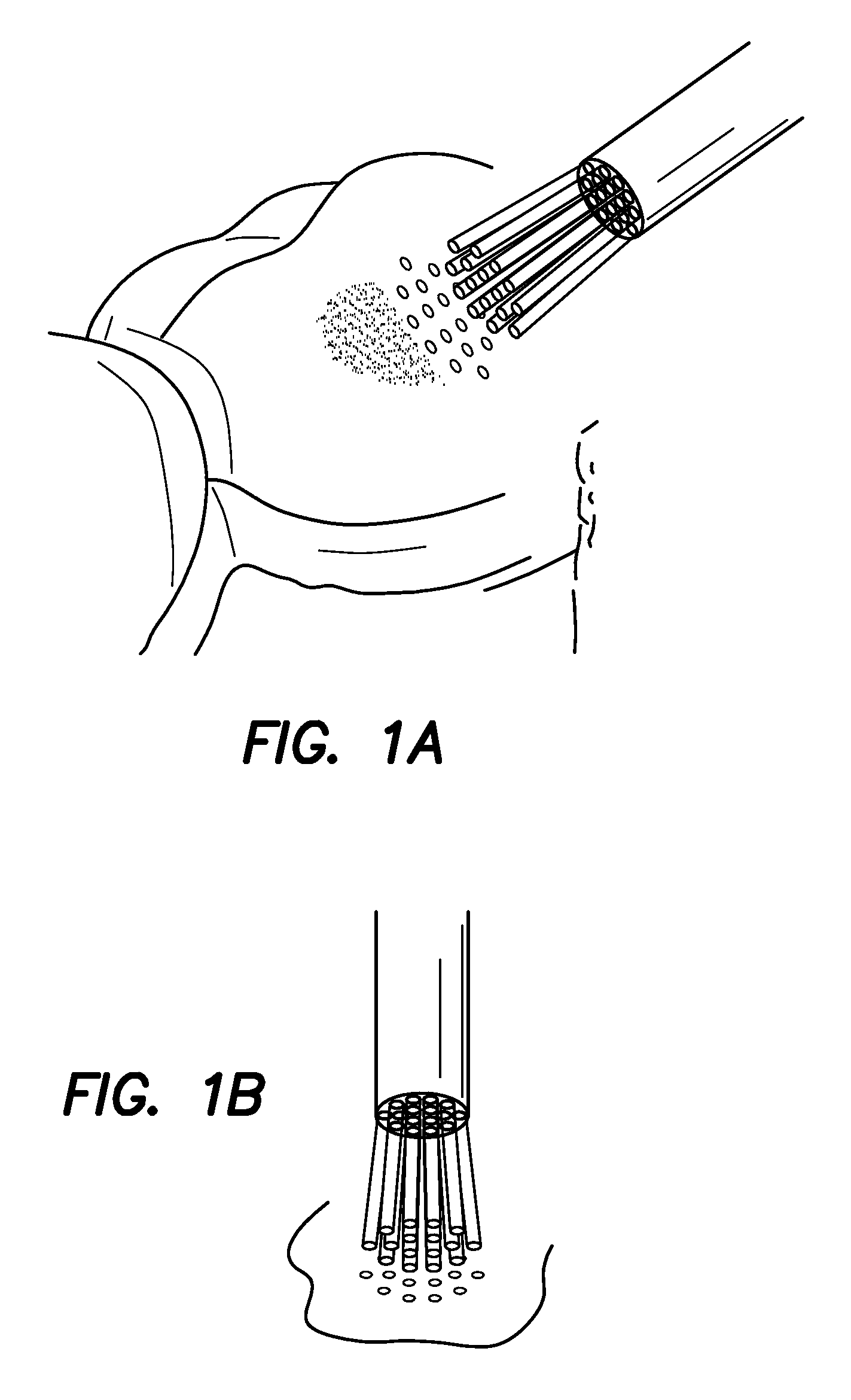 Probes and biofluids for treating and removing deposits from tissue surfaces