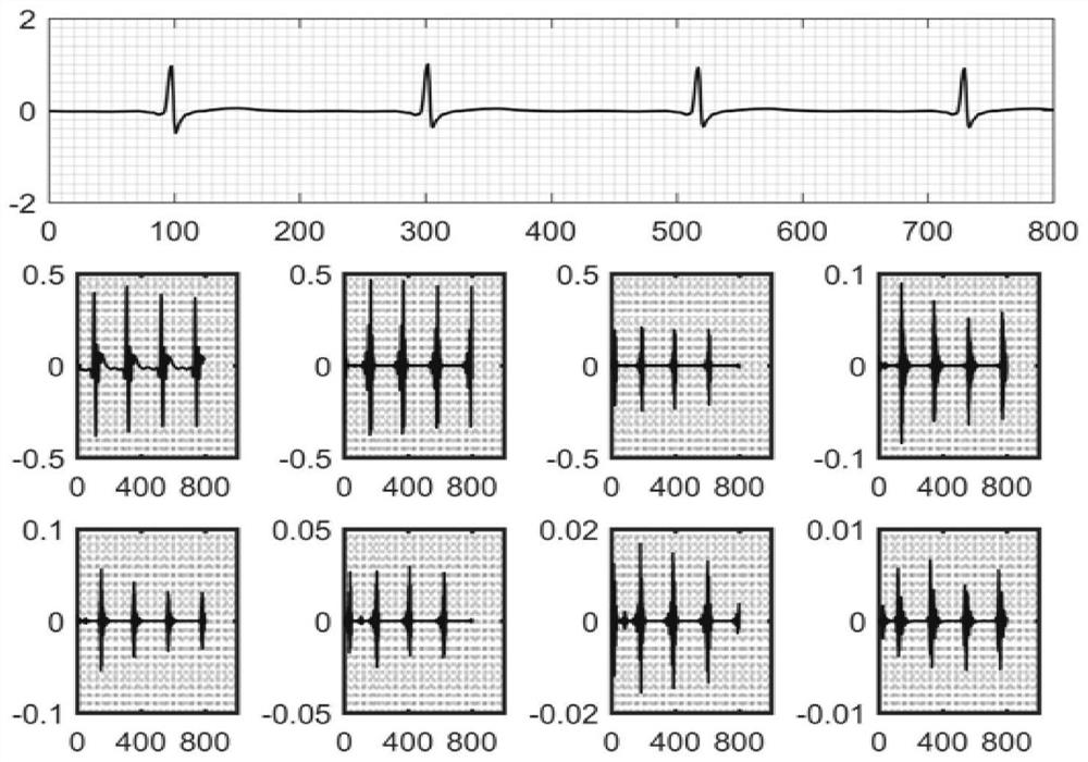 A feature extraction method and corresponding monitoring system for multi-lead ECG signals