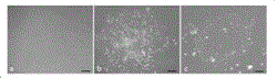 Non-integrative reprogramming method of peripheral blood mononuclear cell for MERRF patient