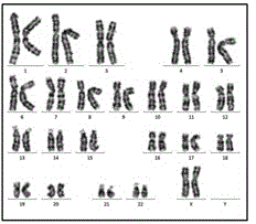 Non-integrative reprogramming method of peripheral blood mononuclear cell for MERRF patient