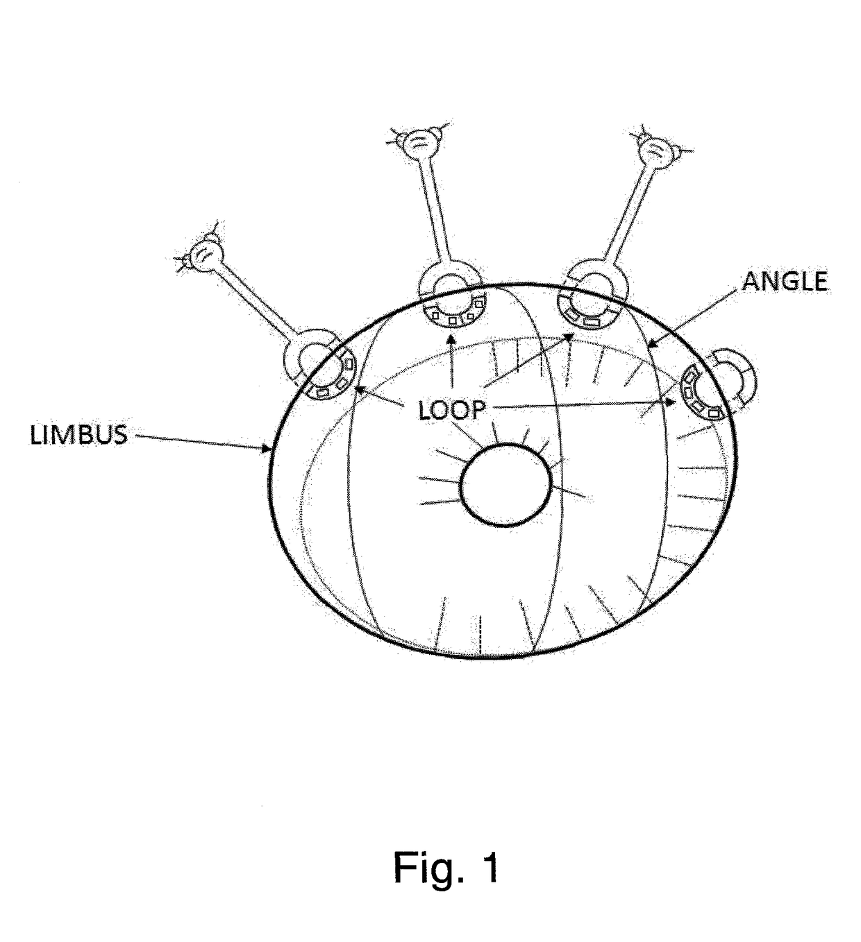 Toroidal glaucoma drainage device