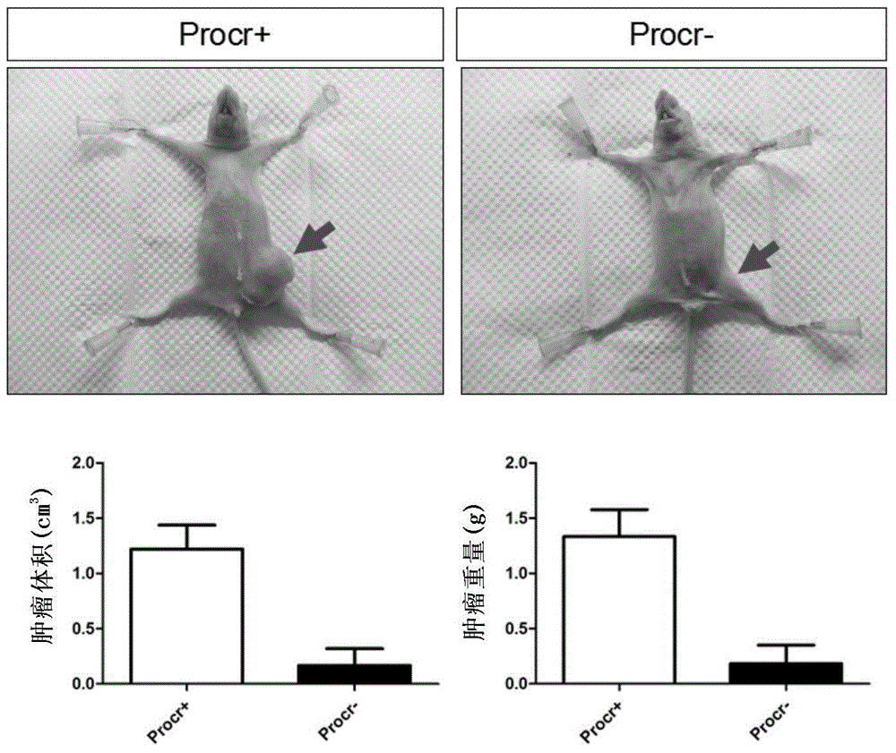 Triple-negative breast cancer marker and applications of triple-negative breast cancer marker in diagnosis and therapy