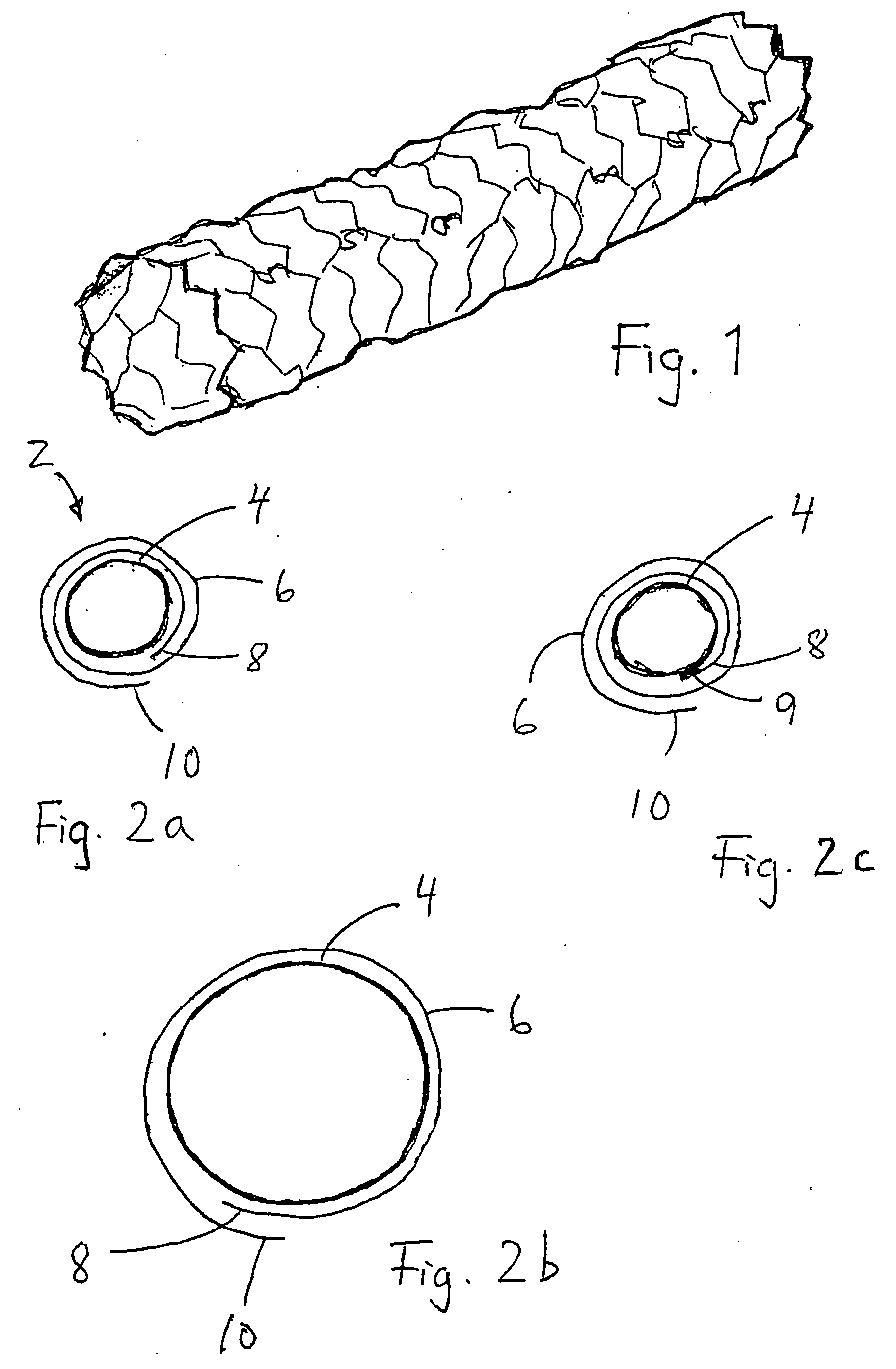 Stent assembly and device for application thereof