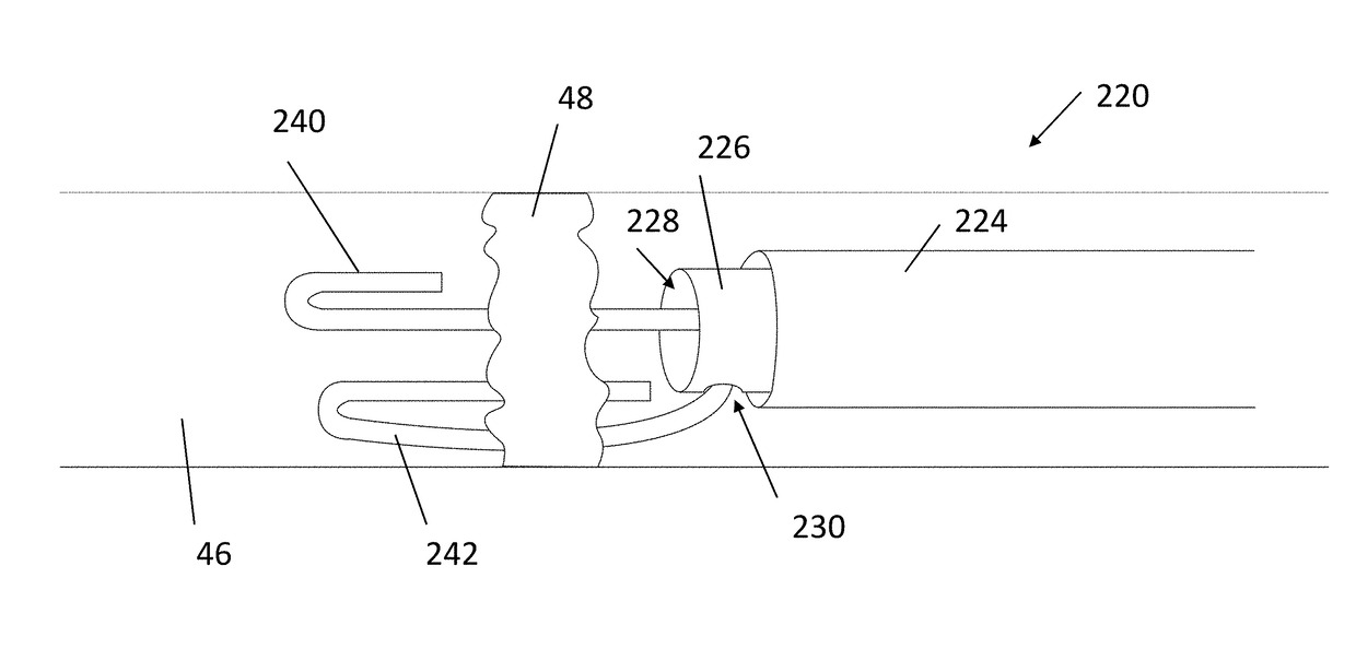 Reentry catheter with expanding anchors