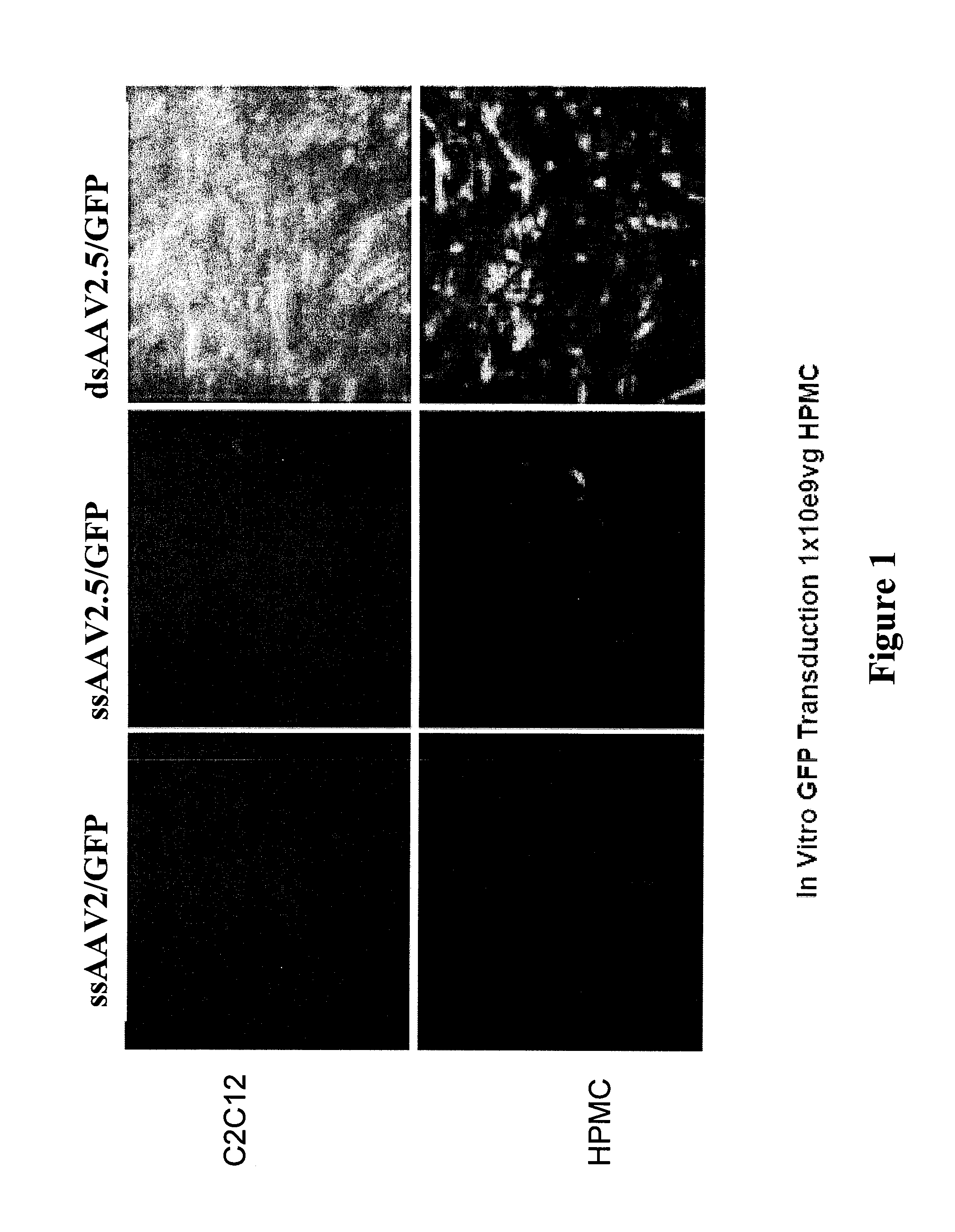 Modified factor viii and factor ix genes and vectors for gene therapy