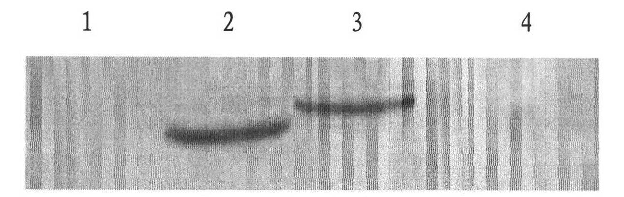 Preparation method and application of virus-like particles of dengue viruses