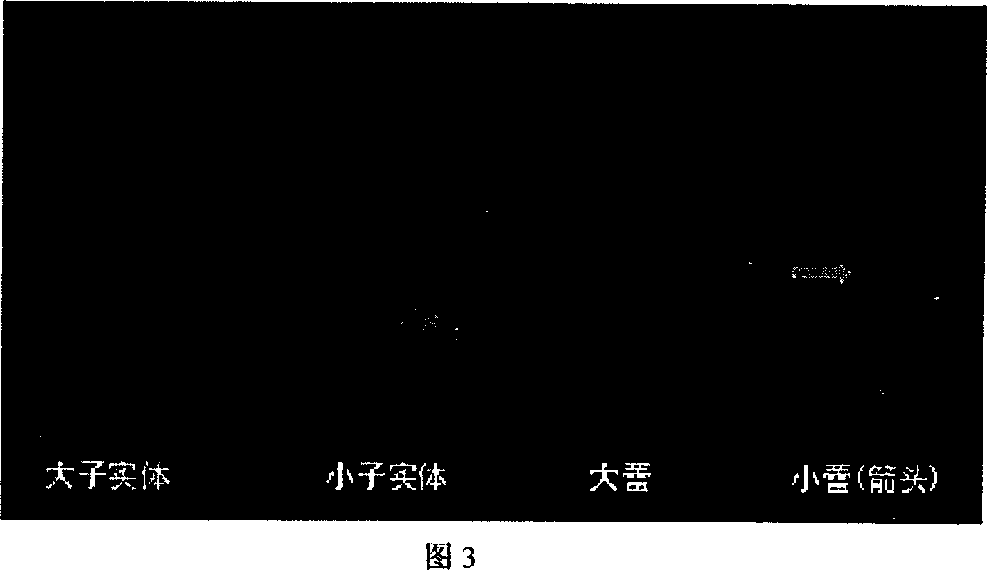 Extraction technology of edible fungus chaff superoxide dismutase