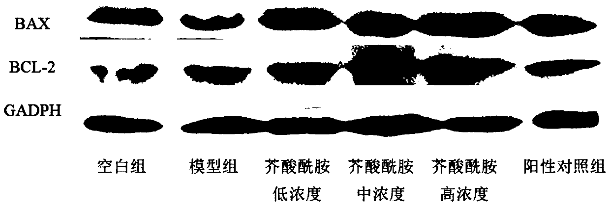 Application of erucyl amide for preparing medicine for treating myocardial damage