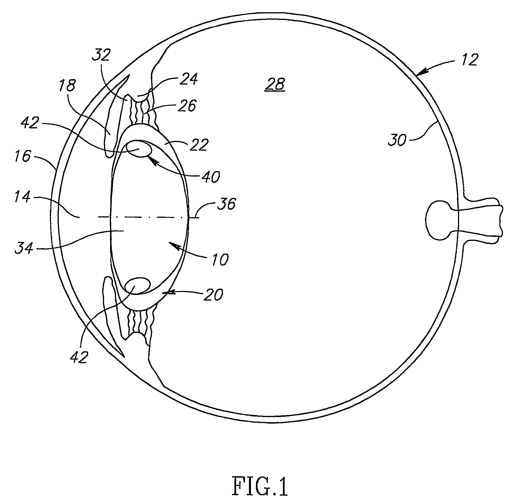 Tensioning intraocular lens assembly