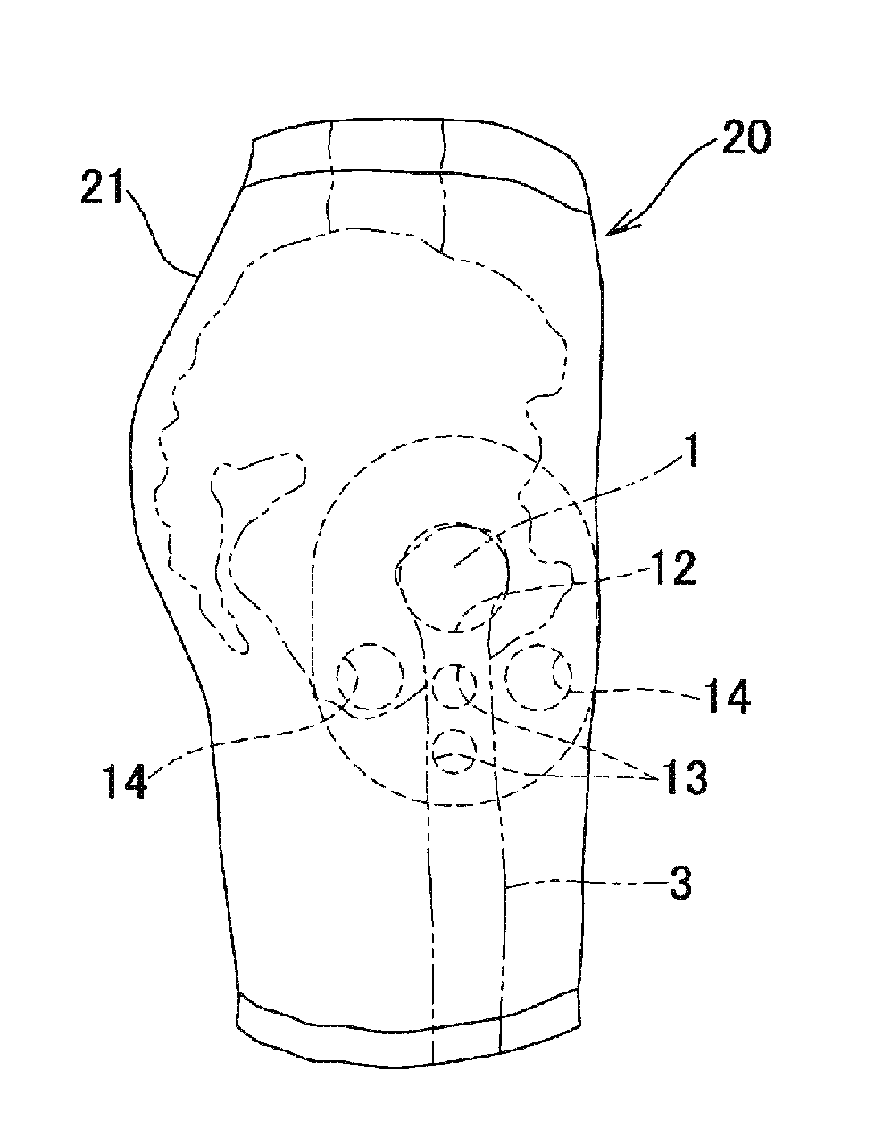 Impact-absorbing pad, clothing furnished with same and method for preventing femoral fractures