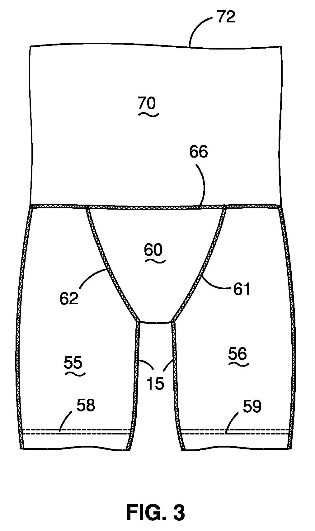 Compression garment