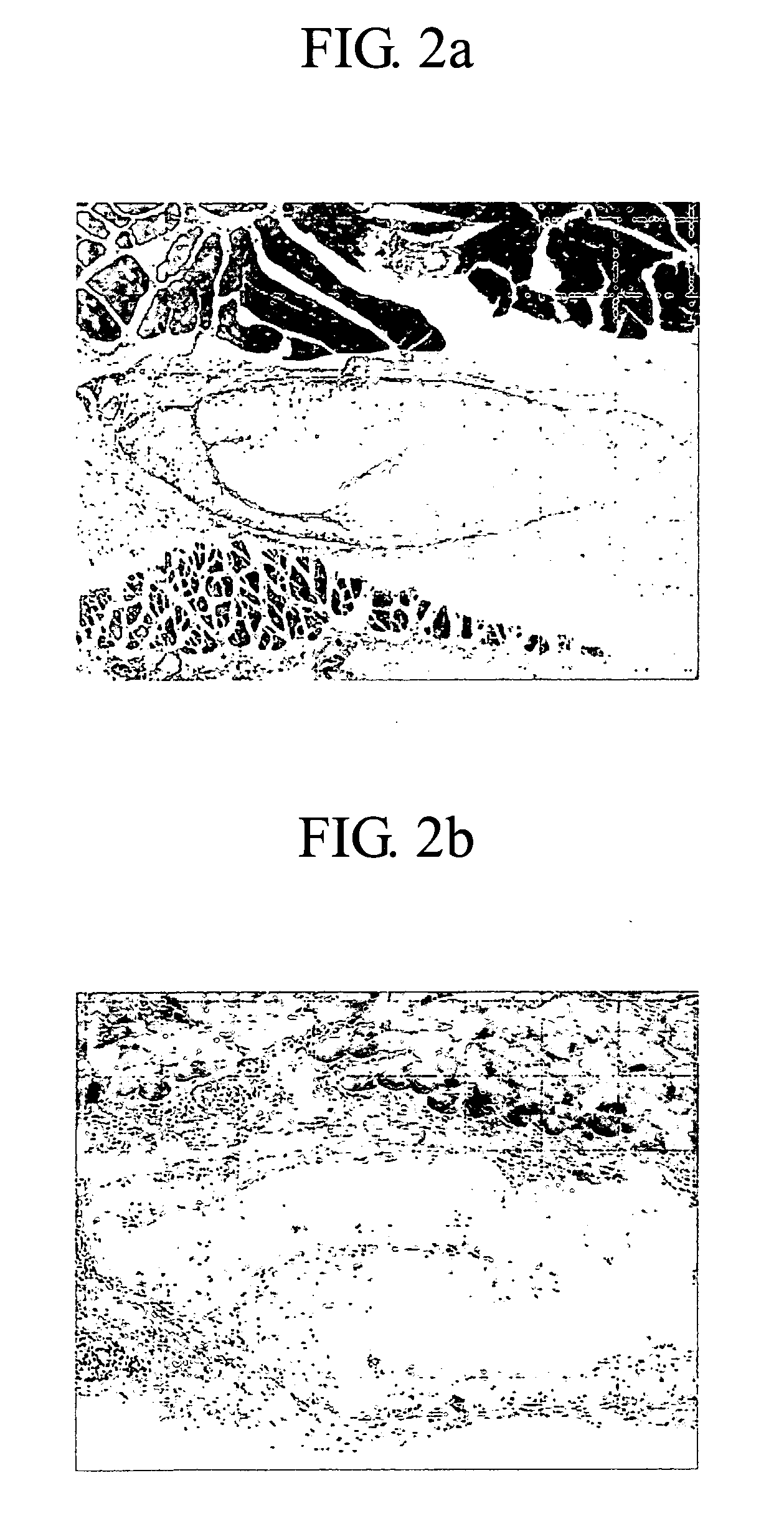 Biological implantation material and method for preparing same