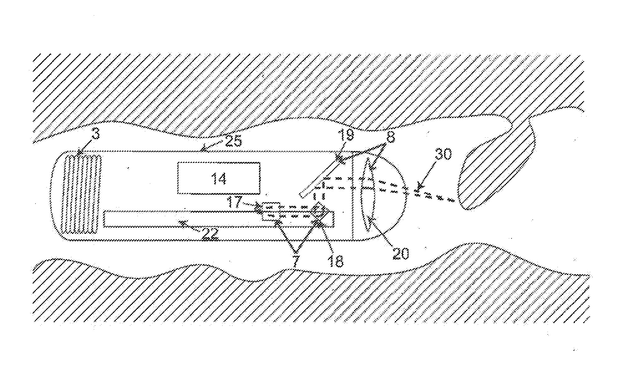 Gastrointestinal electronic pill