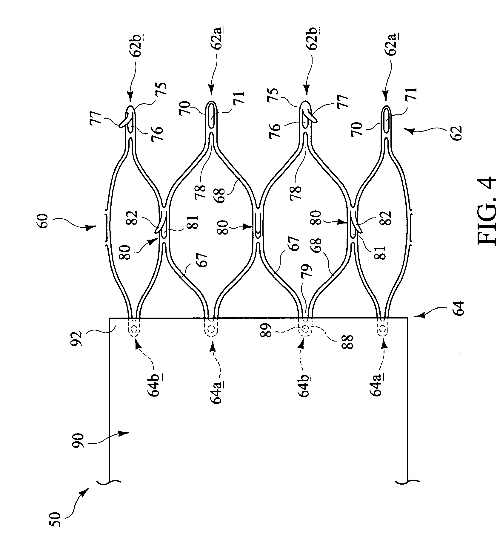 Apparatus and methods for improved stent deployment