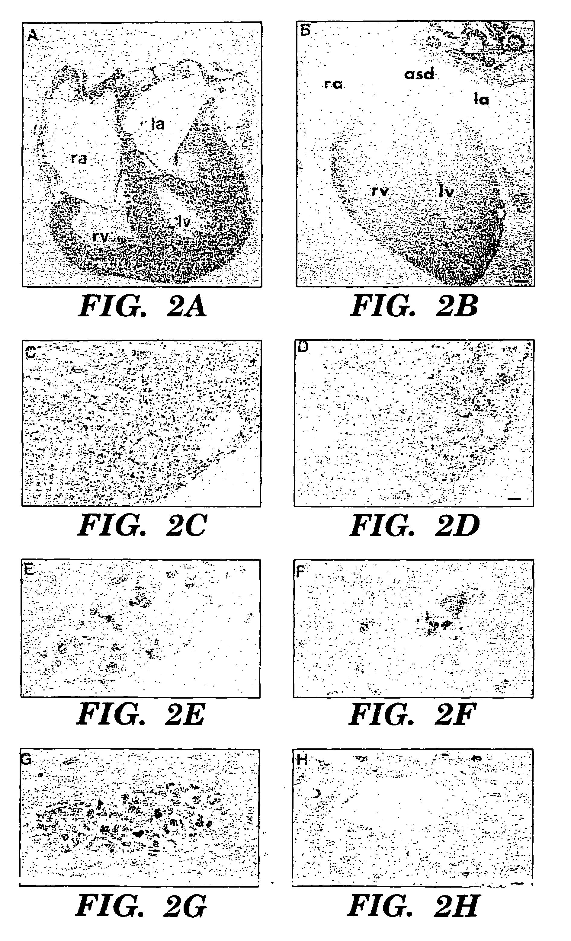 Methods for increasing capillary density and maintaining viability of microvascular cardiac endothelial cells using trk receptor ligands