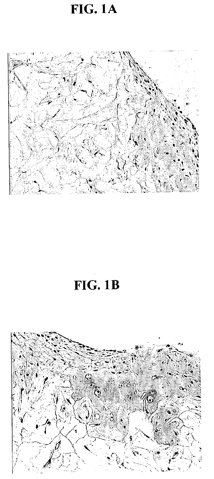 Biocompatible scaffold for ligament or tendon repair