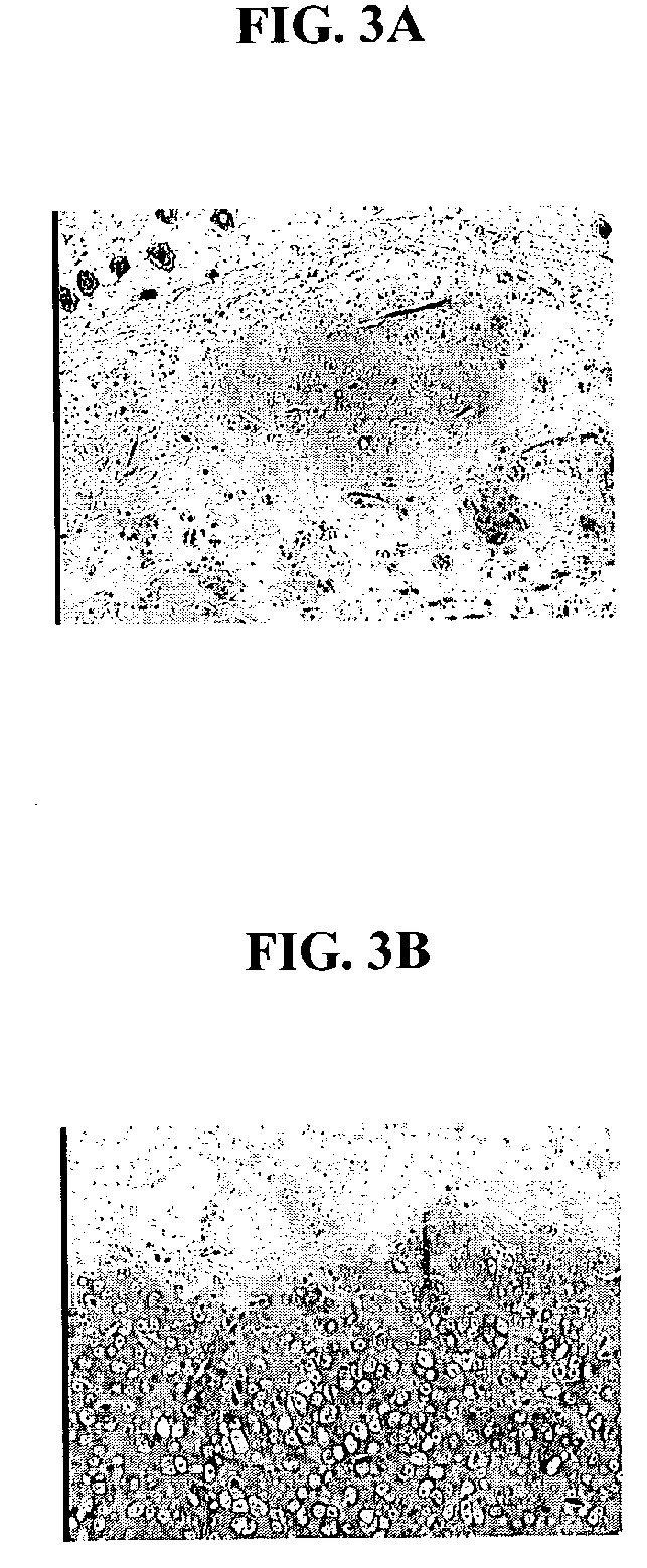 Biocompatible scaffold for ligament or tendon repair