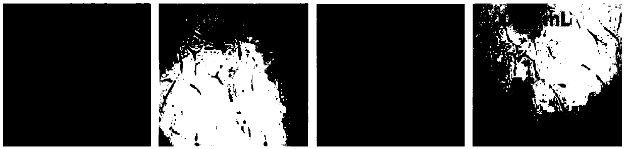 Application of lanostane-type triterpene