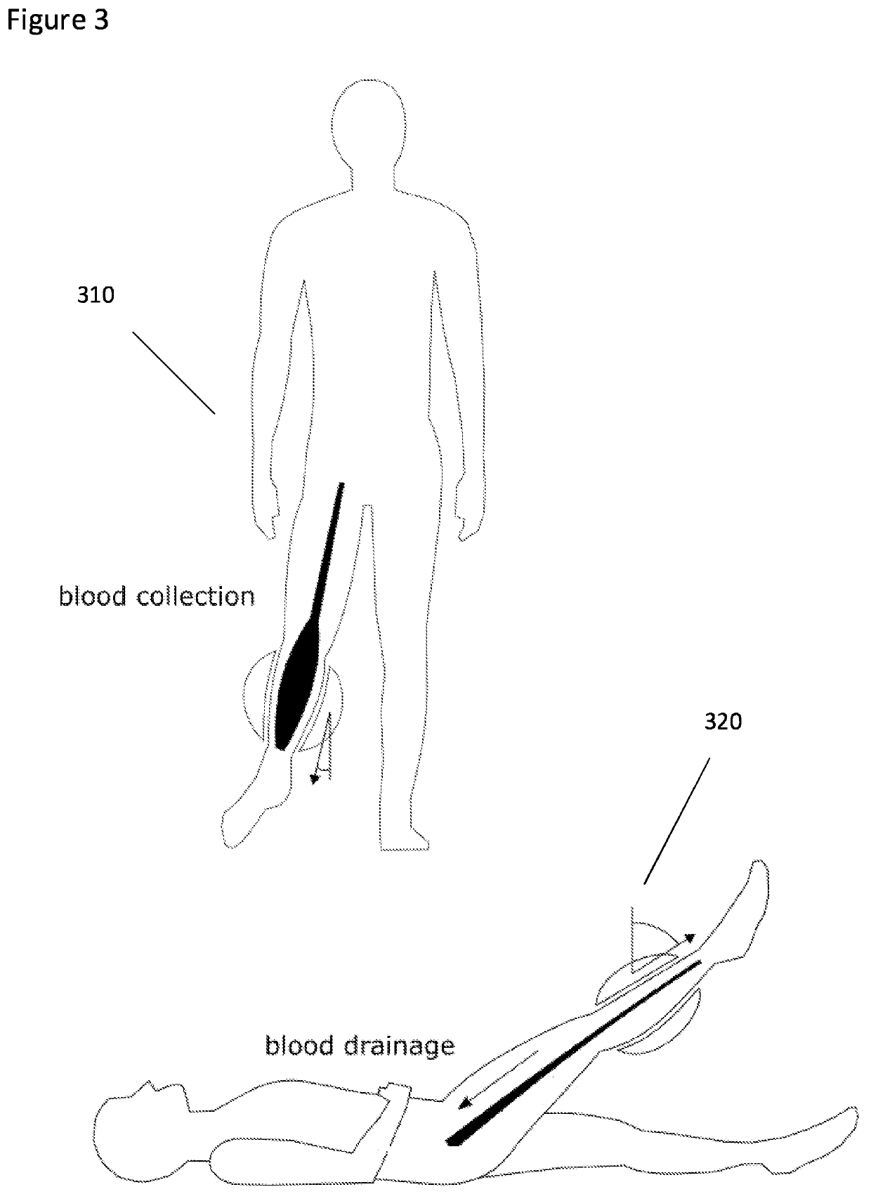 Apparatus and method for determining an indication of blood flow