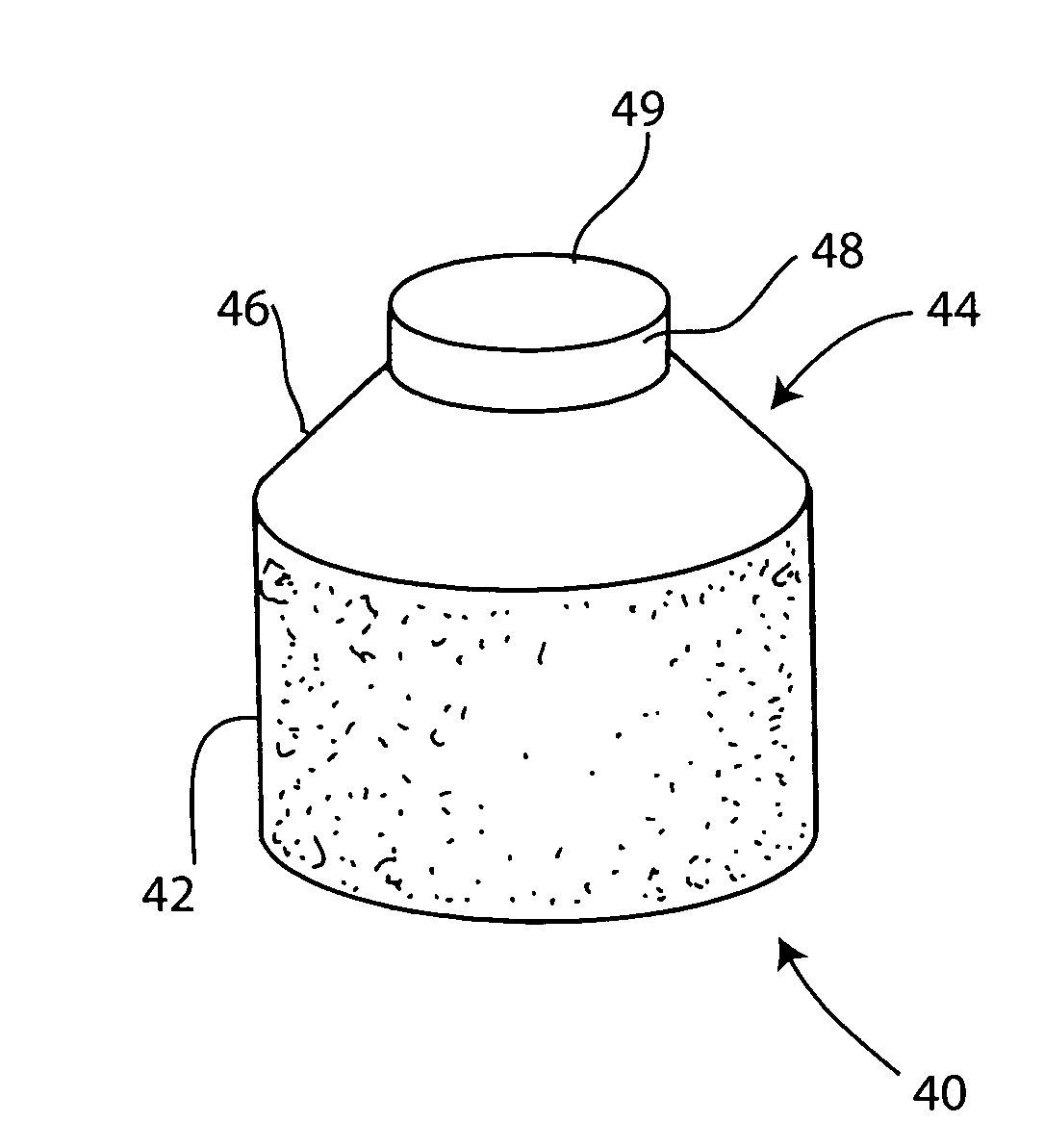 Cartilage allograft plug