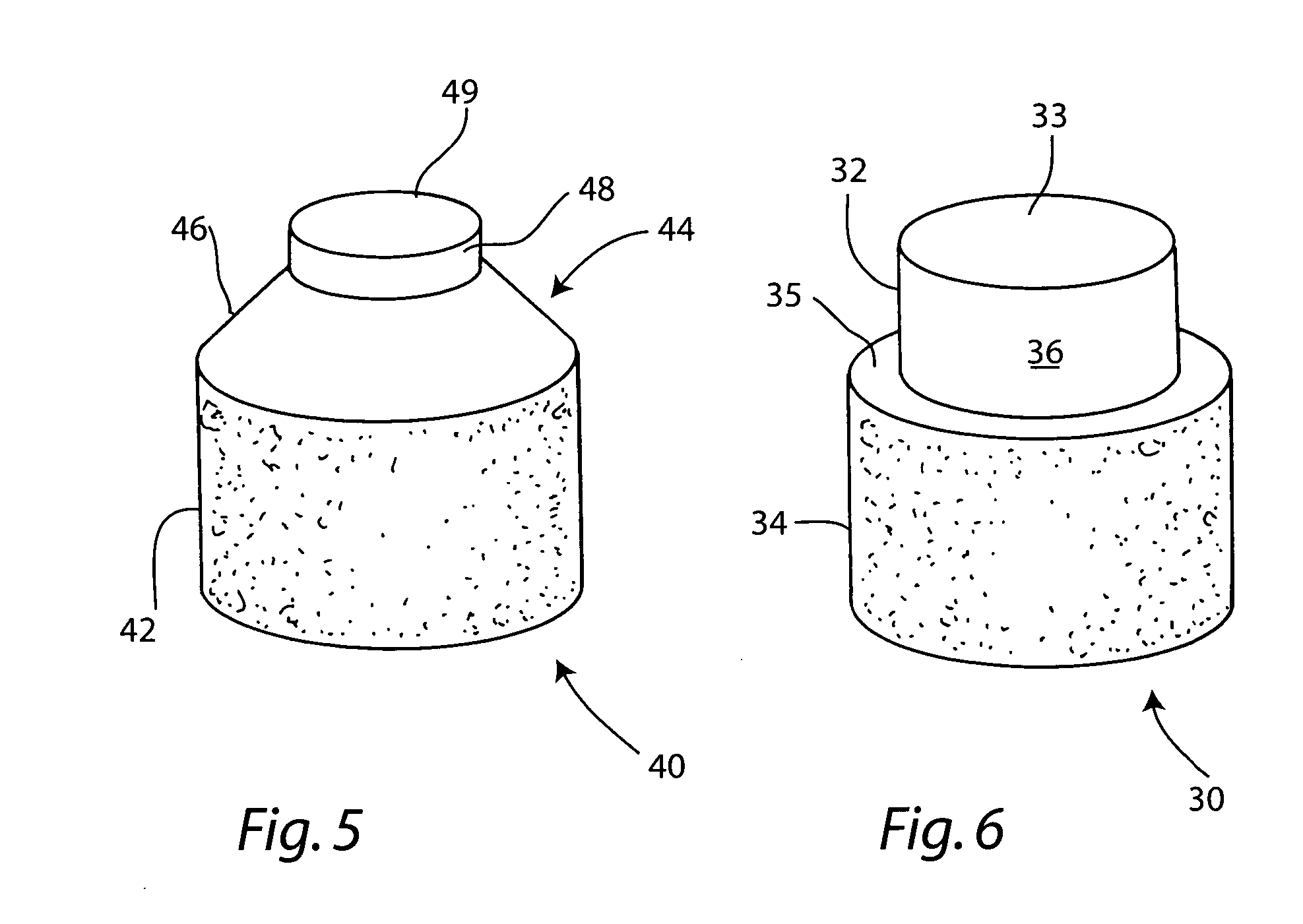 Cartilage allograft plug