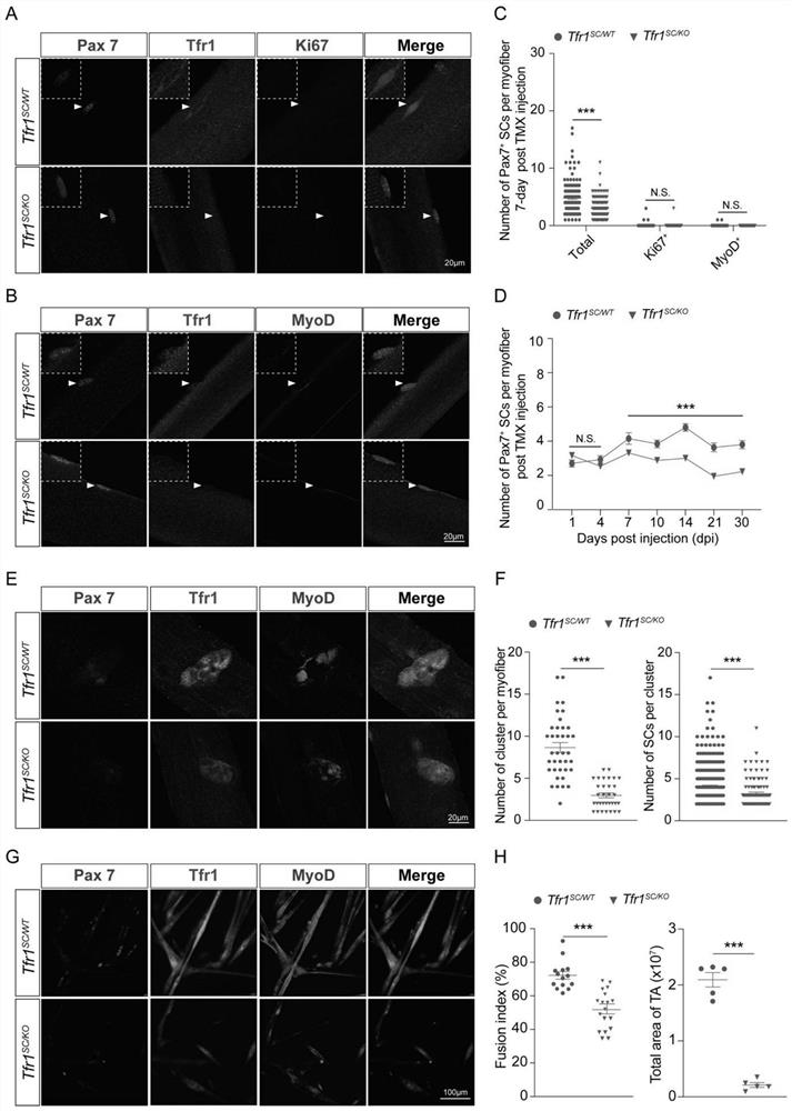 Application of ferroptosis inhibitor in preparation of preparation for improving motion function of aged individuals