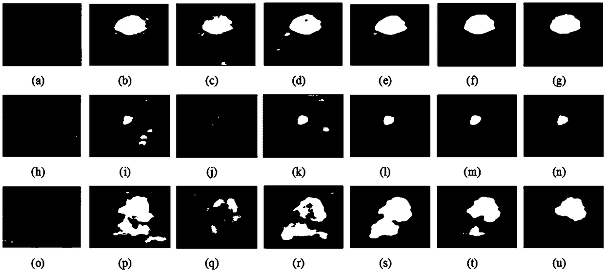 Breast ultrasound image tumor segmentation method based on full convolution network