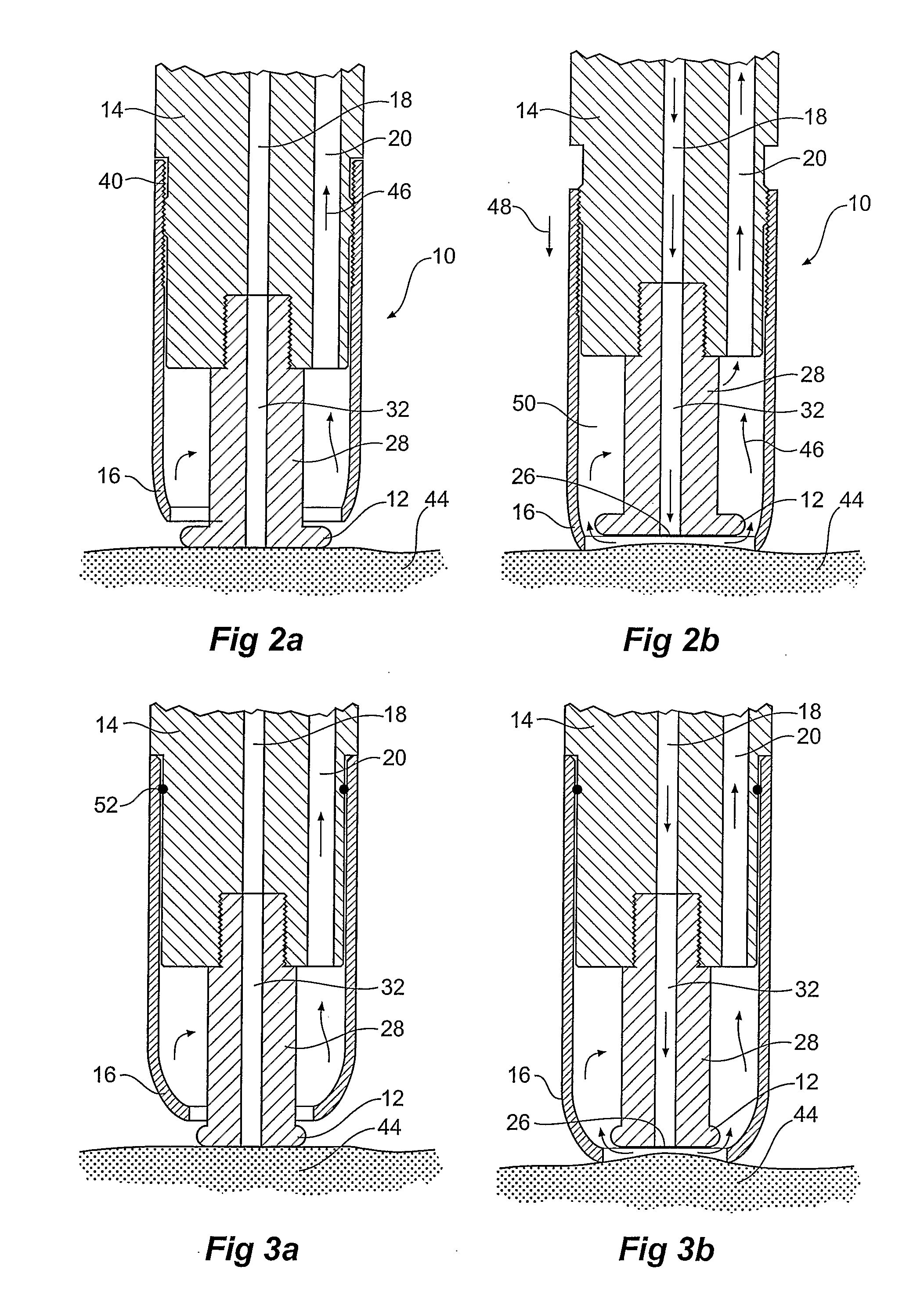 Assembly for Use in Dermabrasion Having an Abrasive Disc