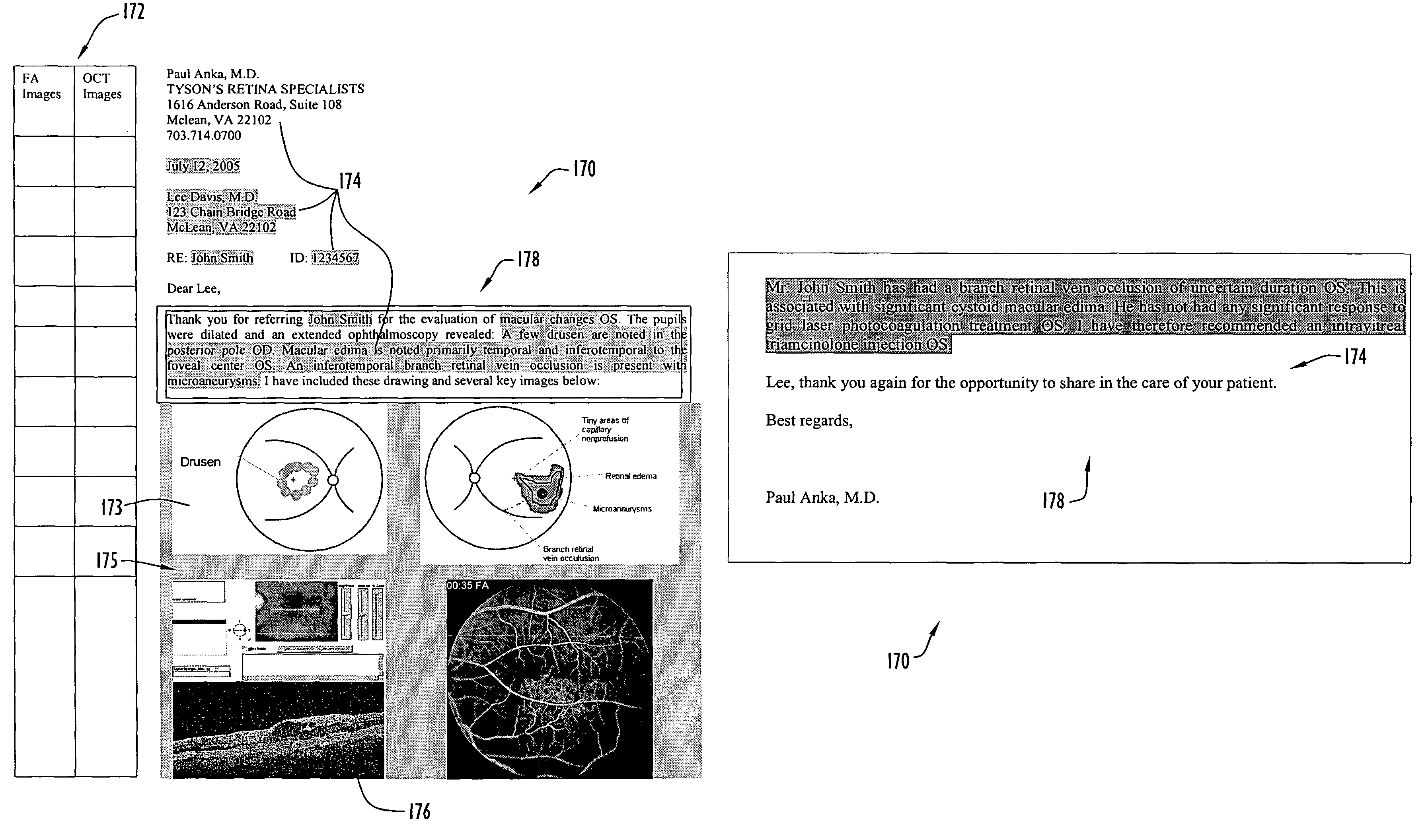 System and method for automated report generation of ophthalmic examinations from digital drawings