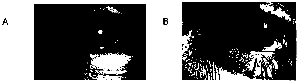 Gene mutation related to microphthalmia and anophthalmos, detection method and use thereof