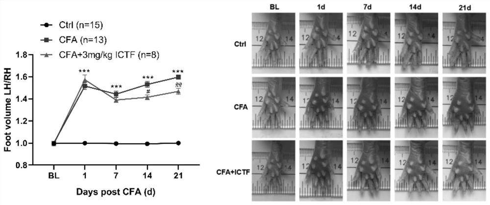 Application of trifluoroicaritin in preparation of medicine for improving pain, swelling and movement functions