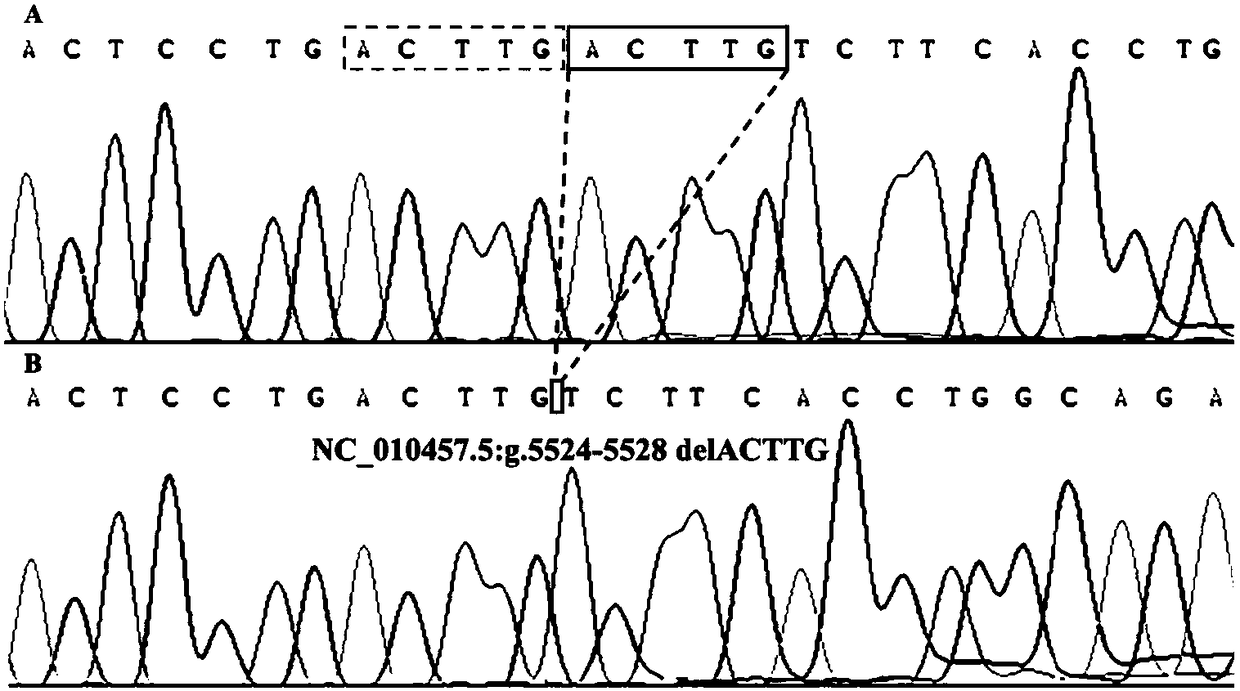 Boar StAR gene 5-bp repetitive deletion polymorphism detection method and application