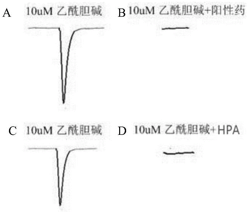 Conotoxin polypeptide, preparation method and application thereof