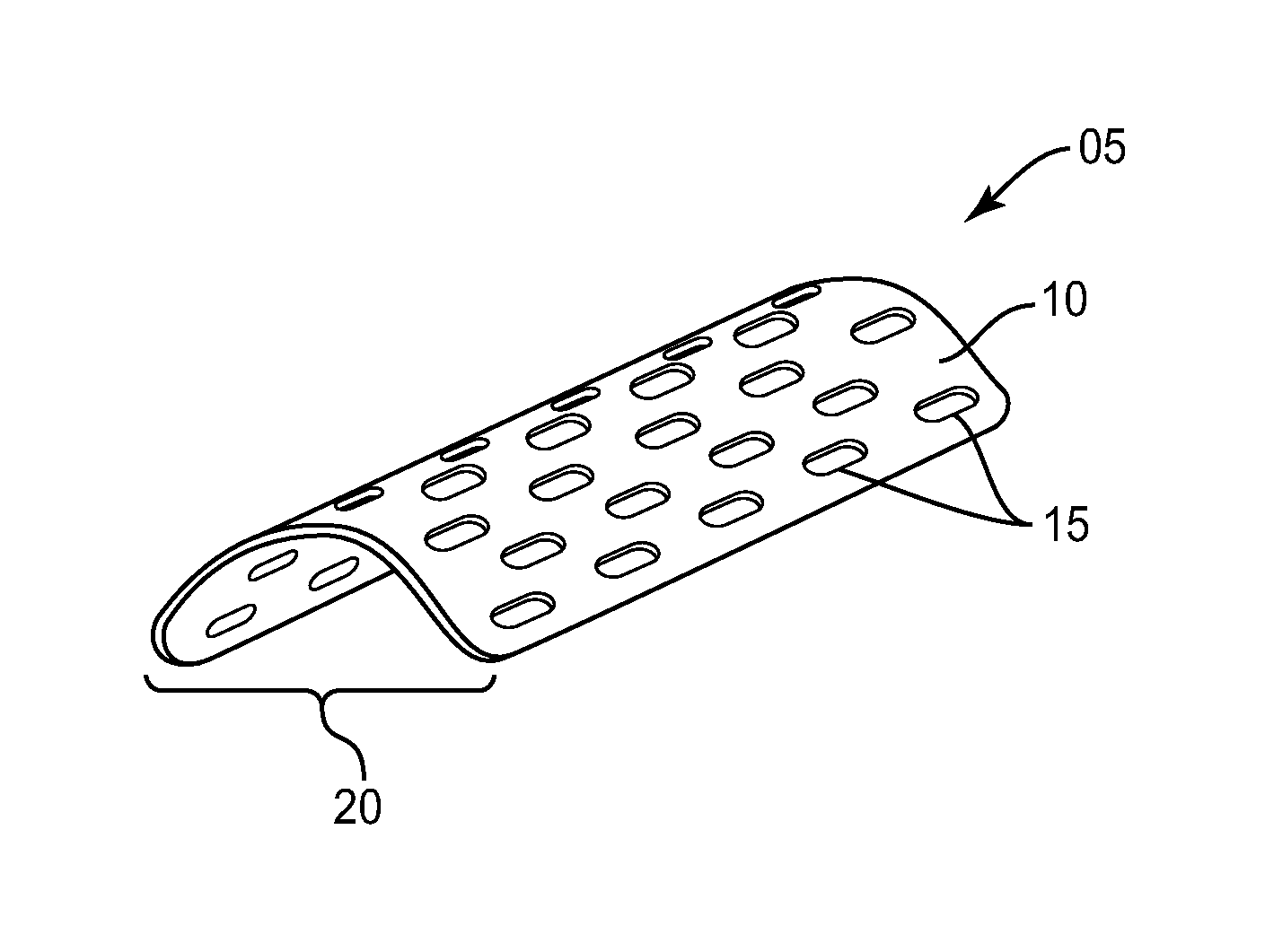 Bio-Remodable Bone Augmentation device and method