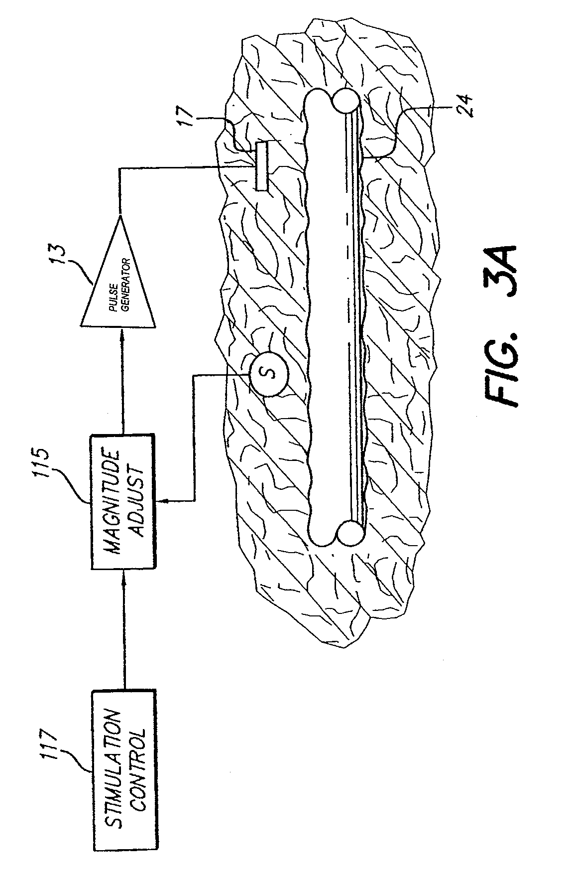 Neural stimulation system providing auto adjustment of stimulus output as a function of sensed pressure changes