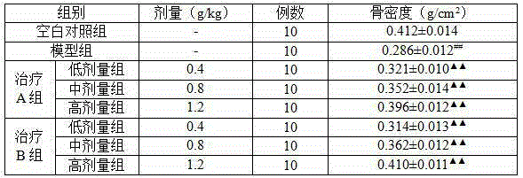 Traditional Chinese medicine composition for treating osteoporosis and preparation method thereof