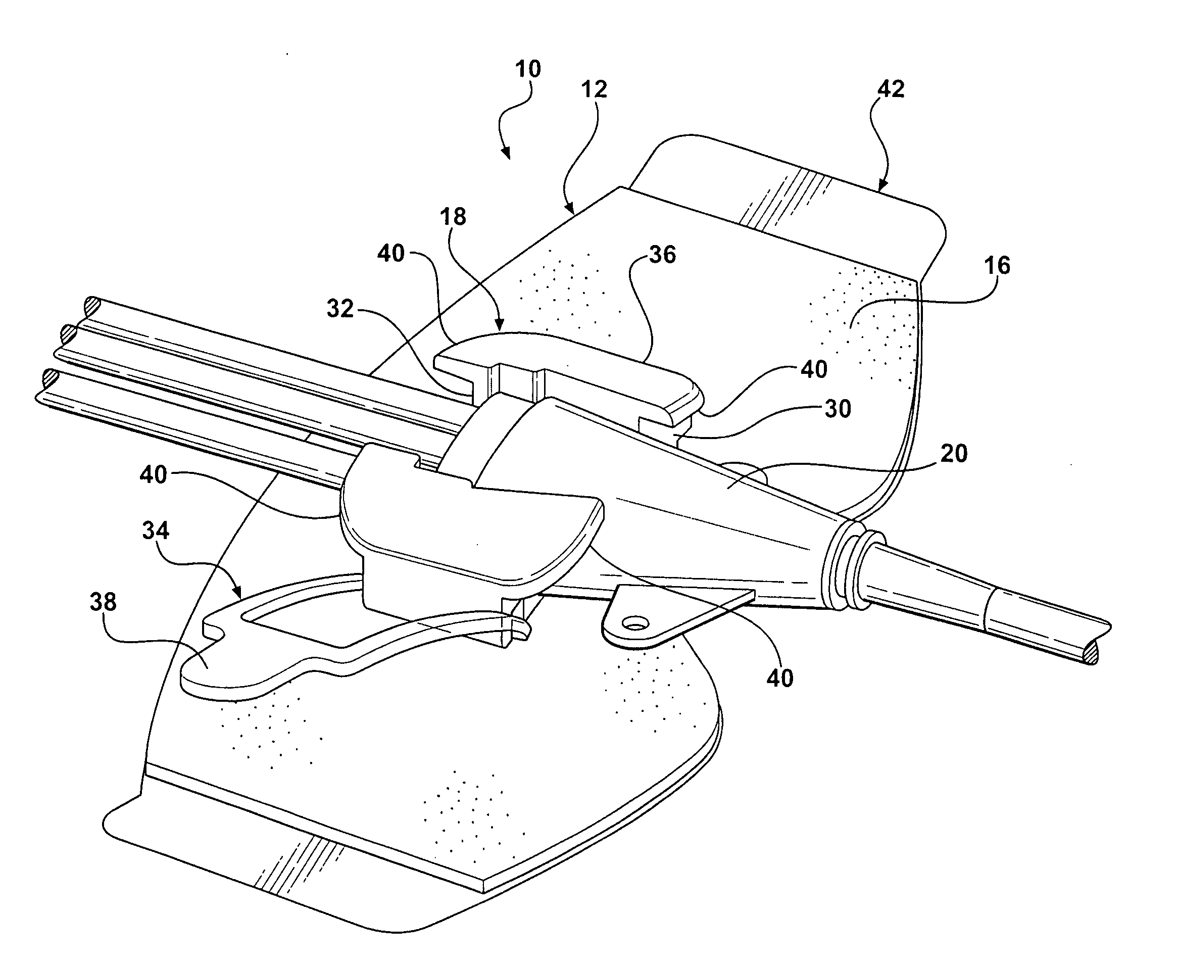 Catheter securement device