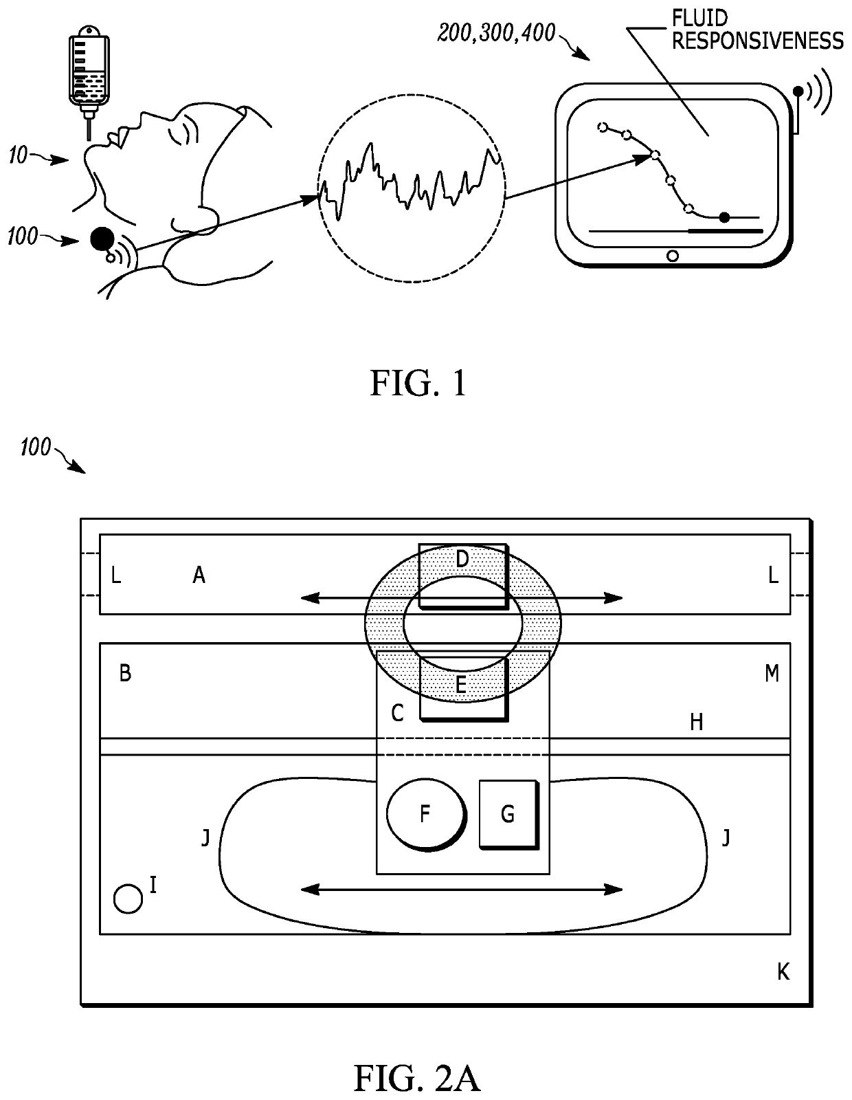 Automated ultrasound apparatus and methods to non-invasively monitor fluid responsiveness