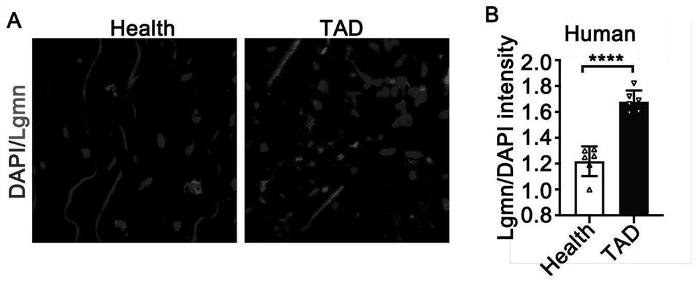 Pharmaceutical application of asparagine endopeptidase inhibitor