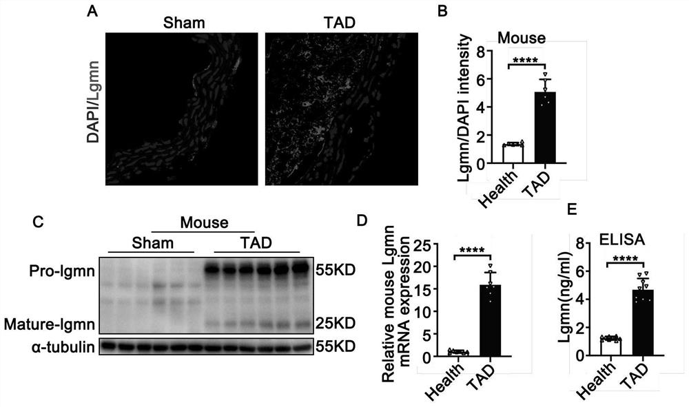 Pharmaceutical application of asparagine endopeptidase inhibitor