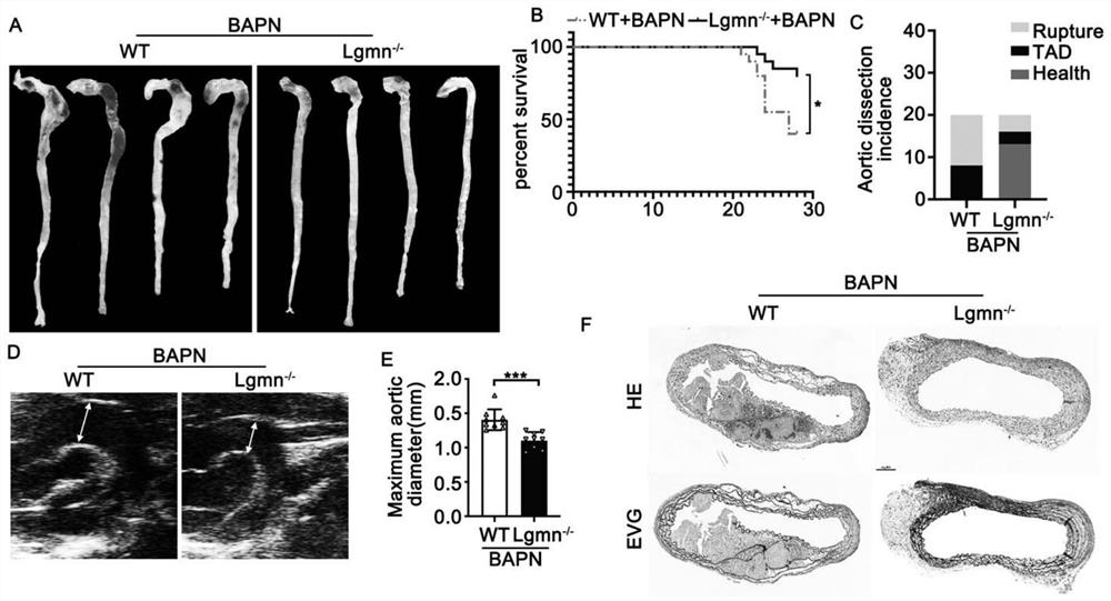 Pharmaceutical application of asparagine endopeptidase inhibitor