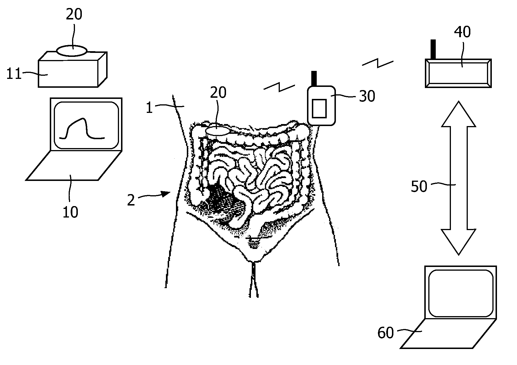 Administration of drugs to a patient